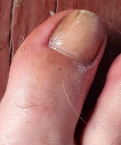 Aidance Skincare & Topical Solutions terrasil Anti-fungal Treatment MAX - 50g 33 71hM6UQ7llL