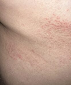 Silver Miracles - Extra Strength Colloidal Silver Soap Unscented 7 Ounce (Pack of 1) 41 71hWGiFHmZL