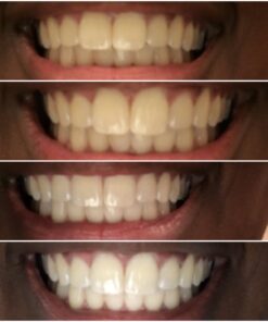 Whitening Tooth Powder with Activated Charcoal for Teeth and Gums (Cool Peppermint) - Safe on Enamel, Detoxifying, Plant-Based and Cruelty Free 2.75 Ounce (Pack of 1) 26 71iIIFIFncL