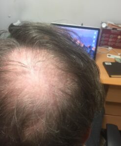 Nutrafol Men's Hair Growth Supplements, Clinically Tested for Visibly Thicker Hair and Scalp Coverage, Dermatologist Recommended - 1 Month Supply 54 71iNEpuNTYL