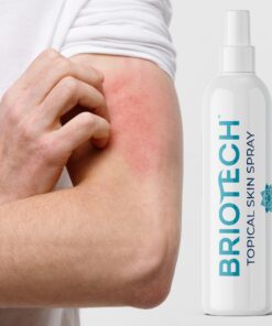 BRIOTECH Hypochlorous Acid Spray, Topical Skin Face & Body Mist, Support Irritations, Soothe Redness, Dry Skin & Scalp, Athletic Itch, Packaging May Vary 3.4 Fl Oz (Pack of 1) 30 71iRg422bL