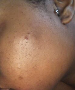 African Black Soap Paste 8 oz. 100% Raw Pure Natural From Ghana. Acne Treatment, Aids Against Eczema & Psoriasis, Dry Skin, Scars and Dark Spots. Great For Pimples, Blackhead, Face & Body Wash. Unscented 8 Ounce (Pack of 1) 48 71iW7lmLYpL