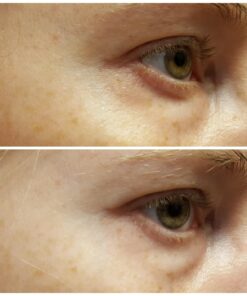 Baebody Eye Gel, Cooling Under Eye Cream For Dark Circles, Puffiness and Bags under Eyes, Eye Cream Anti Aging & Hydrating, Eye Brightening Night Eye Cream - Beauty Gifts for Women 1.7 Fl Oz (Pack of 1) 53 71iaLtSWVTL 1