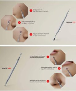 Suvorna Skinpal Pimple Popper Tool Kit | Milia Remover | Lancets for Facial Extraction | Whitehead Extractor Tool | Comedone Extractor | Blackhead Remover Tool | Acne Needle Tool & Cyst Removal Tool. 25 71ifJjQbNL
