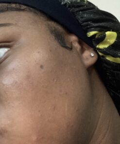 DIM Supplement 200 mg | Estrogen Hormone Balance for Women & Men | Hormonal Acne Supplements, Menopause Support, Antioxidant Support | Clean Label Project Certified, Vegan, Soy Free | 60 Ct. DIM 200mg 59 71ihShW0k2L 1