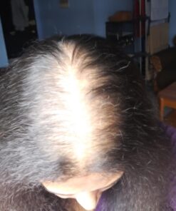 Hair Fibers For Thinning Hair For Women and Men. Hair Building Fibers. Unscented Plant Based Hair Loss Concealing Fillers for Instant Thickening of Balding, Receding Hair Spots, Scalp - Black 14 71imDZP0vGL