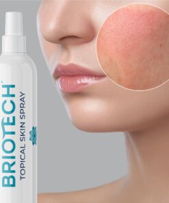 BRIOTECH Hypochlorous Acid Spray, Topical Skin Face & Body Mist, Support Irritations, Soothe Redness, Dry Skin & Scalp, Athletic Itch, Packaging May Vary 3.4 Fl Oz (Pack of 1) 29 71jSg2u9oLL