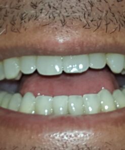 Zen Charcoal Hardwood Activated Charcoal Powder, 100% USA Trees, 8 oz 8 Ounce (Pack of 1) 40 71jall9P9PL