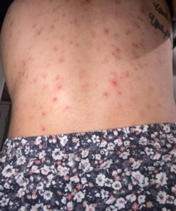 Truremedy Naturals Remedy Tea Tree Oil Body Wash - Body Wash That Helps Body Odor, Ringworm, & Skin Irritations - Tea Tree Soap Body Wash (1 pk, 12 oz) 12 Fl Oz (Pack of 1) 41 71k71Sef9vL