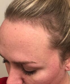 Biotin Shampoo for Hair Growth - Thickening Shampoo for Hair Loss All Natural for Thinning Hair - Rosemary Aloe Vera Coconut - for Women Men - Sulfate Free Paraben Free - Safe for Color Treated Hair 33 71kG98NRKHL