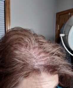 Hairgenics Pronexa Clinical Strength Hair Growth & Regrowth Therapy Hair Loss Shampoo With Biotin, Collagen, and DHT Blockers for Thinning Hair, 8 fl. oz. 38 71kHaeil7uL 1