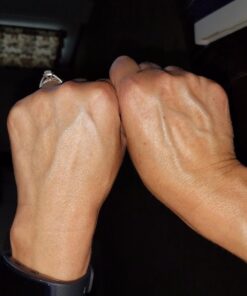 ASTERWOOD NATURALS Pure Vitamin C Facial Serum for Skin Organic Hyaluronic Acid Added; Brightening, Smoothing, Hydrating; Fragrance Free, Paraben Free, 29 ml/1 oz 1 Fl Oz (Pack of 1) 17 71kOyHLbOL