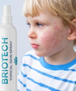 BRIOTECH Hypochlorous Acid Spray, Topical Skin Face & Body Mist, Support Irritations, Soothe Redness, Dry Skin & Scalp, Athletic Itch, Packaging May Vary 3.4 Fl Oz (Pack of 1) 31 71kfAaF6lVL