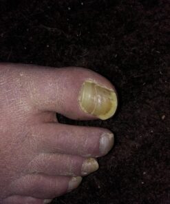 Kerasal Nail Renewal, Restores Appearance of Discolored or Damaged Nails, 0.33 fl oz (Packaging May Vary) 36 71kyZmfQZ2L