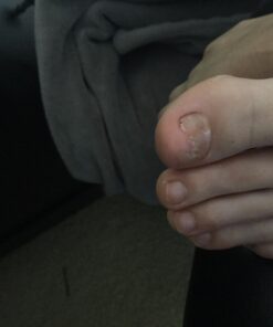 PURELY NORTHWEST-Natural Tea Tree & Peppermint Body Wash for Men & Women-Refreshing Daily Soap for Body Odor & Hygiene, Acne-Effectively Soothes Jock Itch, Chafing & Athletes Foot-Discolored Nails-9oz 9 Fl Oz (Pack of 1) 42 71lHiHfl8WL