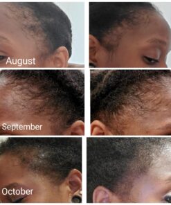 Saw Palmetto & Cayenne Scalp Oil For Hair Growth, Hair Loss Serum, Hair Oil For Dry Damaged Hair And Growth, Hair Growth Serum For Thicker Longer Fuller Healthier Hair, All Natural Vitamin Rich 38 71lJ6ctVLRL