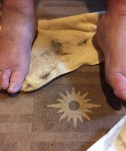 Harperton Podiatrist Toenail Clippers, Heavy-Duty Grooming Tool, Precision Nail Clipper for Thick or Ingrown Toenails, Stainless Steel, Black Toenail Clipper 61 71lP6EJ0wmL