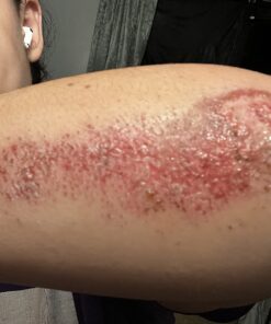 Active Skin Repair Hydrogel - Natural & Non-Toxic First Aid Ointment & Antiseptic Gel for Minor Cuts, Wounds, Scrapes, Rashes, Sunburns, and Other Skin Irritations (Single, 3 oz Gel) 3 Fl Oz (Pack of 1) 44 71lUbdy1TNL