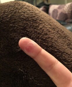 Compound W Nitrofreeze | Wart Removal | 1 Pen & 5 Replaceable Tips 48 71m5KWnt5PL