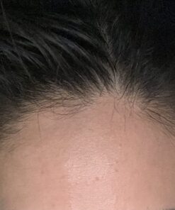 MAJESTIC PURE Castor Oil, 100% Natural Wonder Oil with Numerous Hair, Scalp, Skin and Nails Benefits - Packaging May Vary- 16 fl oz 16 Fl Oz (Pack of 1) 38 71mMLdkrqAL