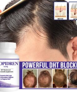 Propidren by HairGenics - DHT Blocker & Hair Growth Capsules to Prevent Hair Loss & Stimulate Hair Follicles, to Stop Hair Loss & Regrow Hair. Proprietary Anti-Hair Loss & Hair Regrowth Treatment. 21 71mUh 1XszL 1