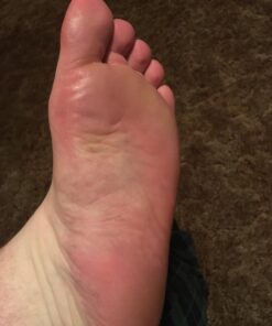 Microplane Colossal Foot File Scraper - The Original Stainless Steel Foot Rasp, Dead Skin/Callus Remover for Feet, Gentle Foot Scrubber, Pedicure Tools for Salon-Quality Foot Care, Black 54 71mfmpzhXvL