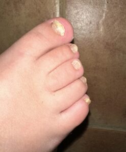 Kerasal Nail Renewal, Restores Appearance of Discolored or Damaged Nails, 0.33 fl oz (Packaging May Vary) 30 71nBElhCFOL