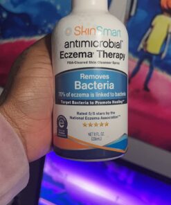 SkinSmart Antimicrobial Eczema Therapy with Hypochlorous Acid, Removes Bacteria so Skin Can Heal, for Adults, Kids and Seniors, 8 Ounce Clear Spray 8 Fl Oz (Pack of 1) 48 71nJaXv9sEL