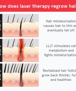 iRestore Essential Laser Hair Growth System - FDA Cleared Hair Loss Treatments for Men & Women & Hair Growth Products for Men with Thinning Hair, Hair Regrowth Treatments Laser Cap, Red Light Therapy 33 71nKo7xzEPL 1