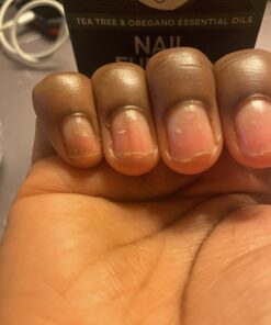 Toenail Fungus Treatment Extra Strength with 25% Undecylenic Acid - Fungal Nail Treatment for Toe Nail & Fingernails - Antifungal Nail Repair Solution for Discoloured & Ingrown Nails – Made in USA 0.5 Fl Oz (Pack of 1) 50 71nWAYJ ryL 3