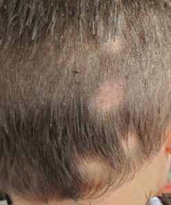 Aidance Skincare & Topical Solutions terrasil Anti-fungal Treatment MAX - 50g 29 71ntS6o30kL