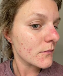 Omax3 Natural Omega 3 Fish Oil Pills 1500 MG EPA DHA - Omega3 Fatty Acid Muscle & Joint Support Supplements - Gluten Free, Wild Caught, Non GMO, 30-Day Supply Blister Packed (1 Box) 60 Count (Pack of 1) 27 71o4Sjc3IvL