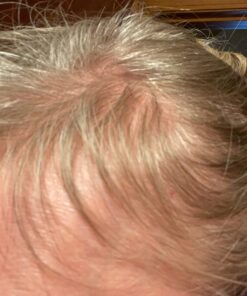 BeLive Biotin Gummies with MultiVitamins, Folate, Inositol – Supports Hair Growth, Healthy Skin & Nails – Vegan, Pectin Based – Strawberry Flavor (1) 60 Count (Pack of 1) 38 71o75WOXW1L