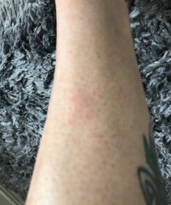 Puracyn First Aid Wound and Skin Repair - Wound Care Spray for Cuts, Scrapes, Minor Sores, Minor Burns, and Other Skin Irritations. 16 Ounces 16 Fl Oz (Pack of 1) 13 71oILPKrIJL