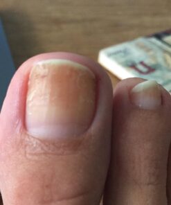 3 in 1 Professional Foot Spa Kit-with Tea Tree Foot & Body Soak-Tea Tree Body Wash & Nail Blend-Soothes Dry, Burning & Itchy Skin-Refreshes Unwanted Foot Odor-Restores Unhealthy Nails-Purely Northwest Tea Tree Oil 3 Piece Set 39 71oM9hevXML 1