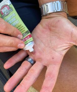 Brave Soldier Antiseptic Healing Ointment - Best Wound Care & Skin Repair Cream with Tea Tree Oil - First Aid Supplies for Burns, Wounds & More, 1 Ounce 39 71oZ2024cKS