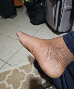 Dr. Nordyke's Wound Honey New Zealand Manuka Honey for Infections,Burns,Cuts and Scars (80g) 2.8 Ounce (Pack of 1) 22 71odaNlR9vL