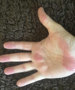 Structured Colloidal Silver Gel for Burns and Wounds - Cooling Silver Extra Strength 35ppm Silver Gel 36 71p1tQOYSWL