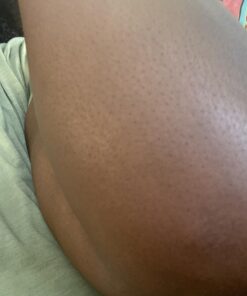 TEA TREE OIL BALM -100% All Natural | Great Cream for Soothing Irritations like Eczema, Psoriasis, Rashes, Insect Bites, Folliculitis, Acne, Itches, Dry Chapped Heels, Cuticles, Saddle Sores and more! 43 71q6VWe70kL