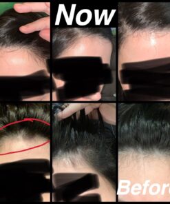 Nutrafol Men's Hair Growth Supplements, Clinically Tested for Visibly Thicker Hair and Scalp Coverage, Dermatologist Recommended - 1 Month Supply 52 71qJZuNOXTL