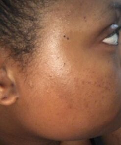 African Black Soap Paste 8 oz. 100% Raw Pure Natural From Ghana. Acne Treatment, Aids Against Eczema & Psoriasis, Dry Skin, Scars and Dark Spots. Great For Pimples, Blackhead, Face & Body Wash. Unscented 8 Ounce (Pack of 1) 49 71qLmb G68L