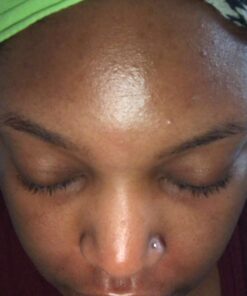 African Black Soap Paste 8 oz. 100% Raw Pure Natural From Ghana. Acne Treatment, Aids Against Eczema & Psoriasis, Dry Skin, Scars and Dark Spots. Great For Pimples, Blackhead, Face & Body Wash. Unscented 8 Ounce (Pack of 1) 50 71qmbZb0zwL