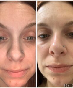 Licorice Extract Skin Brightening Serum by Eva Naturals (1 oz) - Dark Spot Corrector, Serum For Face - Gently Exfoliates For An Even Complexion - With Peptides, CoQ10 and Vitamin E - Face Serum 17 71r2HY3oiL