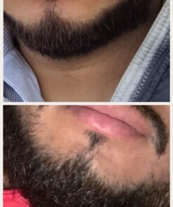 Maxx Beard -#1 Beard Growth Solution, Natural Solution for Maximum Beard Volume-2 Month Supply 31 71rBQv4GD3L
