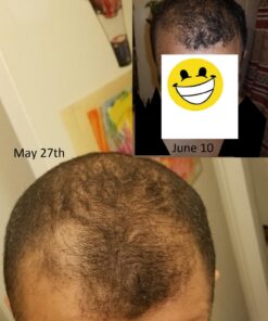 Volumizing Biotin Shampoo for Thinning Hair - Thin Hair Shampoo with Rosemary Argan and Essential Oils for Hair Care - Vegan Sulfate Free Shampoo for Damaged Dry Hair Paraben and Cruelty Free Sandalwood 16 Fl Oz (Pack of 1) 42 71rT93xAMyL