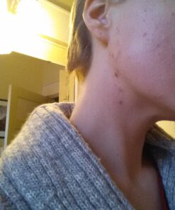 InstaNatural BHA Exfoliating Face Serum, Minimizes Lines, Wrinkles, and Blemishes, with Vitamin C and Salicylic Acid, 1 Fl Oz 34 71rYVbHpkFL