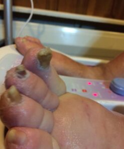 Harperton Podiatrist Toenail Clippers, Heavy-Duty Grooming Tool, Precision Nail Clipper for Thick or Ingrown Toenails, Stainless Steel, Black Toenail Clipper 62 71rzOul4ZL