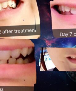 Crest 3D Whitestrips, Glamorous White, Teeth Whitening Strip Kit, 28 Strips (14 Count Pack) Flavorless 28 Count (Pack of 1) 31 71sMLVaJCTL