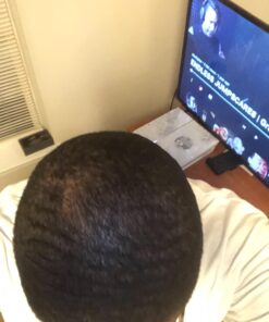 DrFormulas HairOmega 3-in-1 Hair Growth Vitamins with DHT Blocker, Biotin for Women & Men | Hair Skin and Nails Supplement for Hair Loss, 120 Pills 120 Count (Pack of 1) 43 71saw3LsvRL