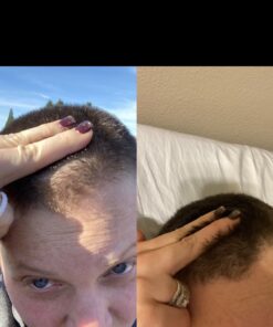 Wild Growth Hair Oil 4oz "Pack of 2" 4 Fl Oz (Pack of 2) 34 71ssFtt8L